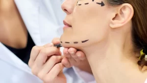 An Overview of the Face lifting Treatment Methods